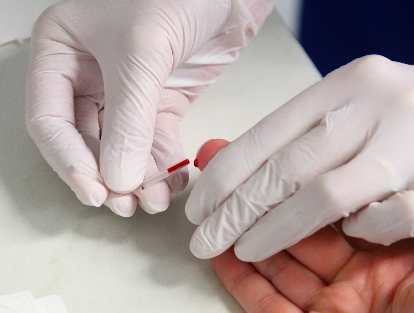 HIVi kiirtestiks on vaja vaid paar tilka verd sõrme otsast.