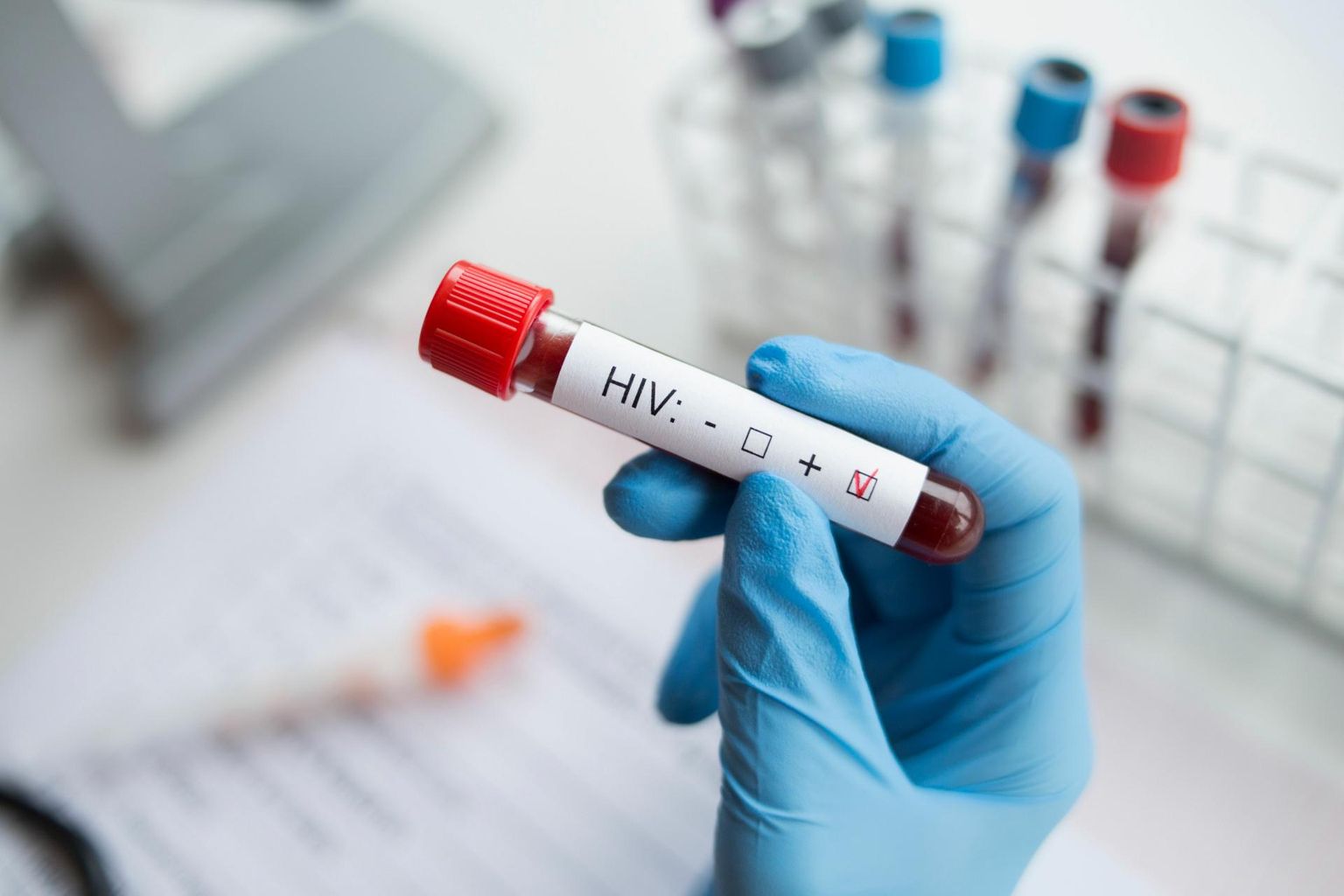 Eelmisel aastal diagnoositi Eestis 125 uut HIV-i juhtu.