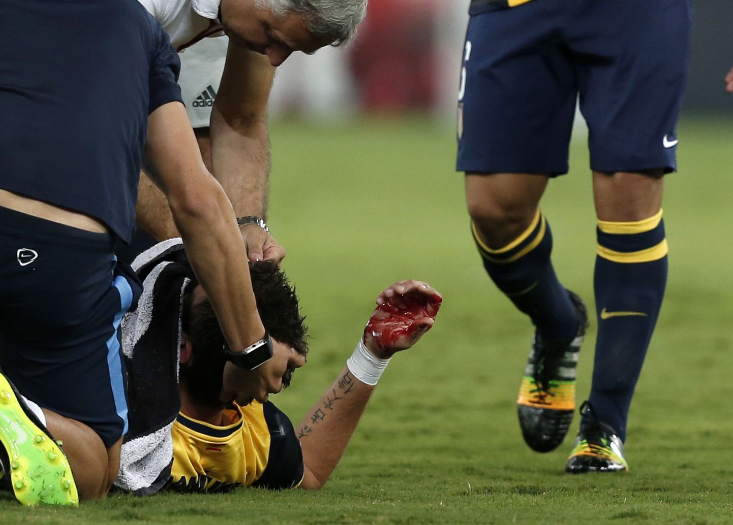 Atletico ründaja Mario Mandžukic murdis kohtumises Olympiakosega ninaluu.