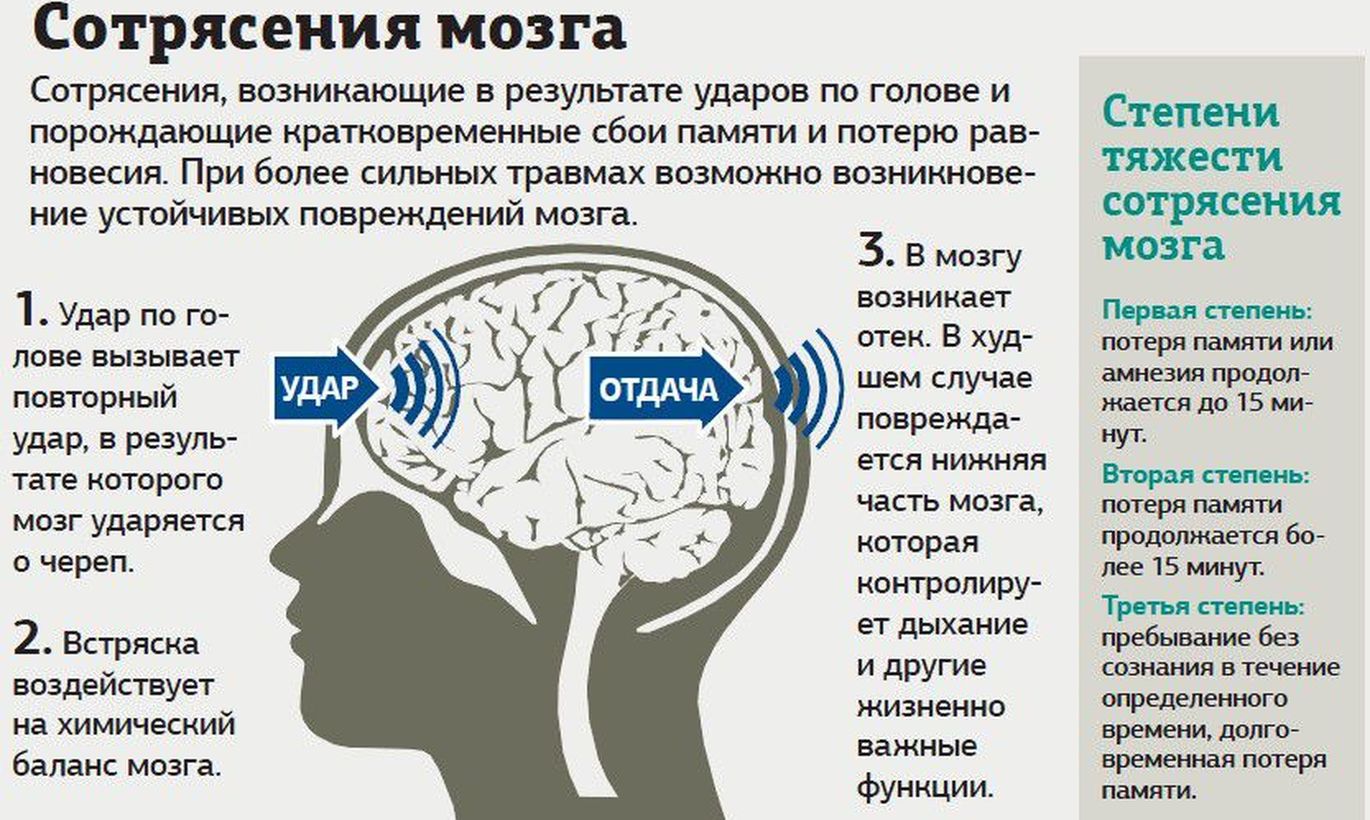 Схема лечения сотрясения головного мозга у детей Схема лечения сотрясения головного мозга у детей