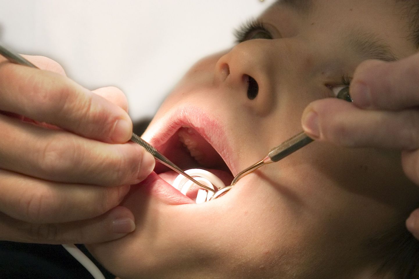 Heli- ja elektrilaineid edastav seadeldis kaotab hambaarsti-hirmu.