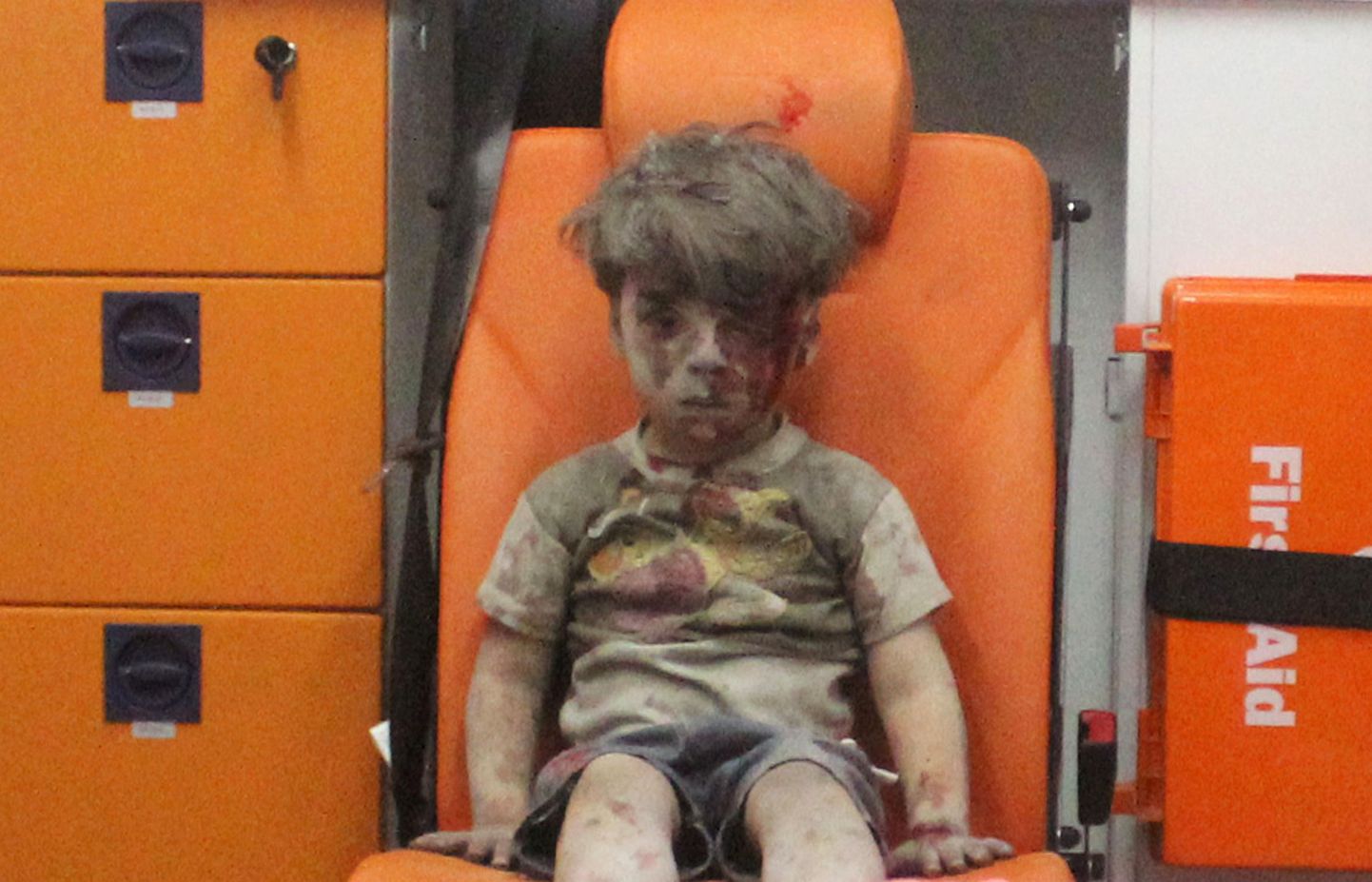 Õhurünnakus vigastada saanud süüria poiss Omran Daqneesh