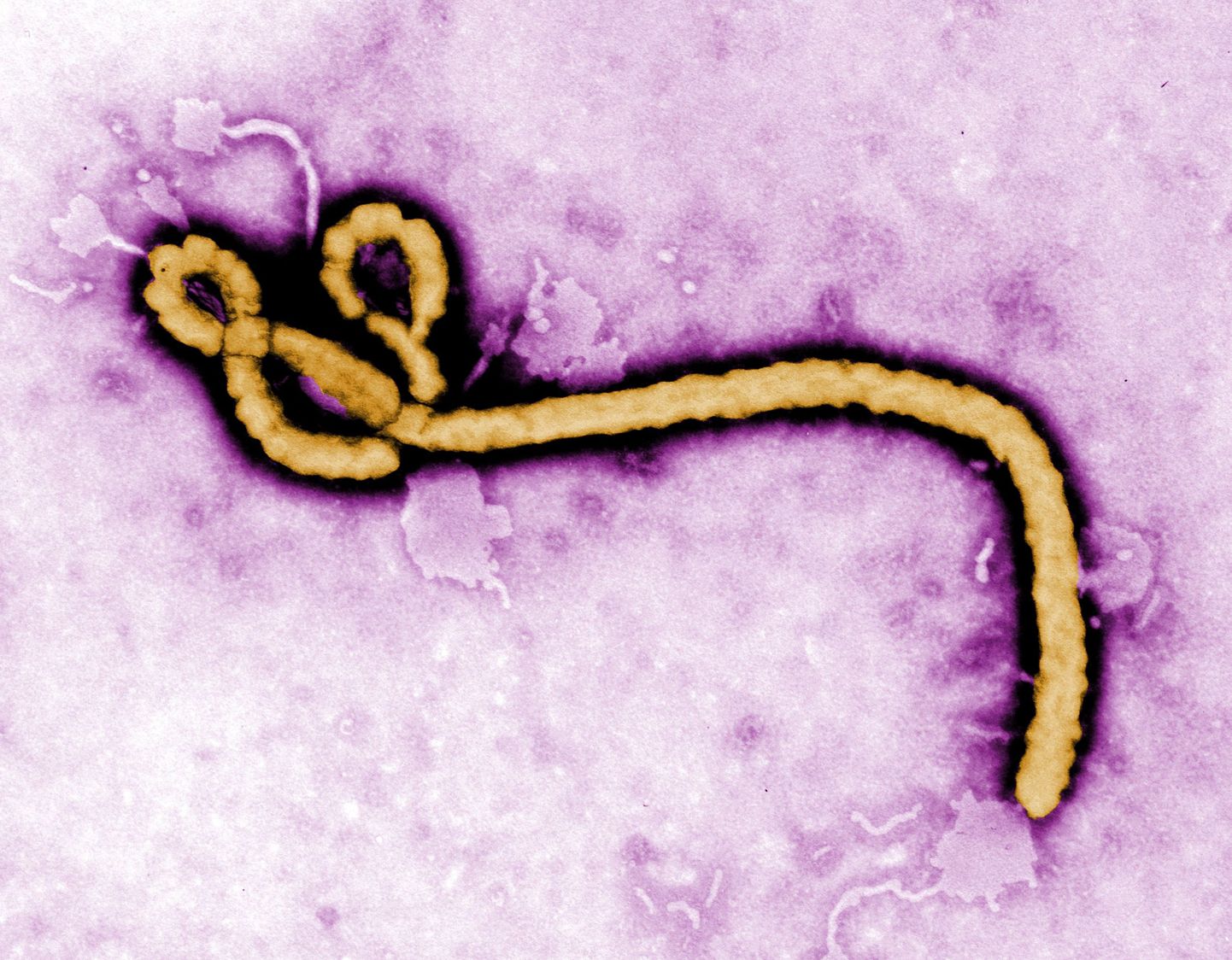 Ka möödunud aastal Aafrikas palju inimelusid nõudnud Ebola viirus võis põhjustada ellujääjates kohandumist ja eelujäämist soosivaid geneetilisi mutatsioone.
