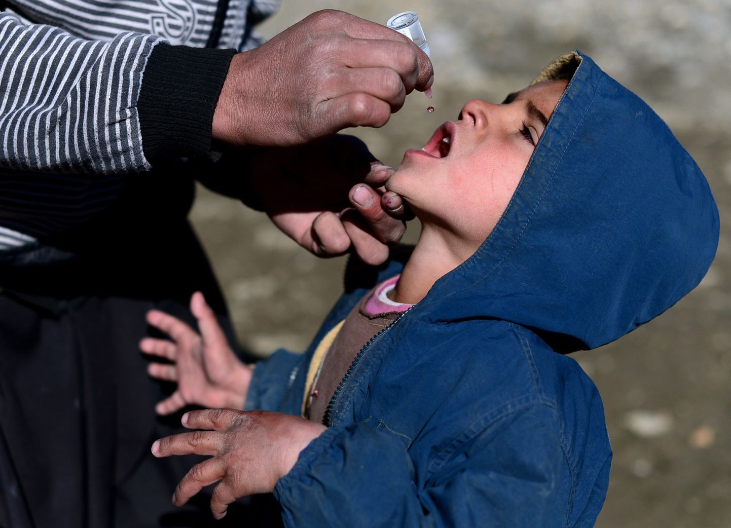 Kuigi arengumaades püütakse lapsi lastehalvatuse vastu vaktsineerida, on just sealt alguse saanud uus suur haiguspuhang.