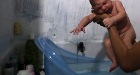 Zika viiruse vaktsiinile jõuti samm lähemale