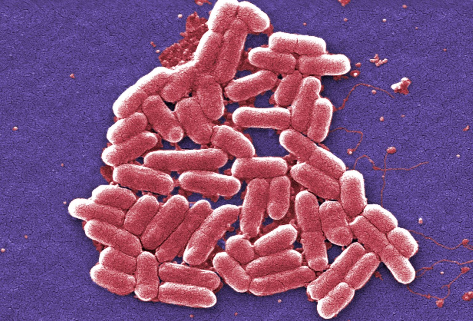 Peagi võivad levima hakata bakterid, mis on kõigi antibiootikumide suhtes resistentsed.