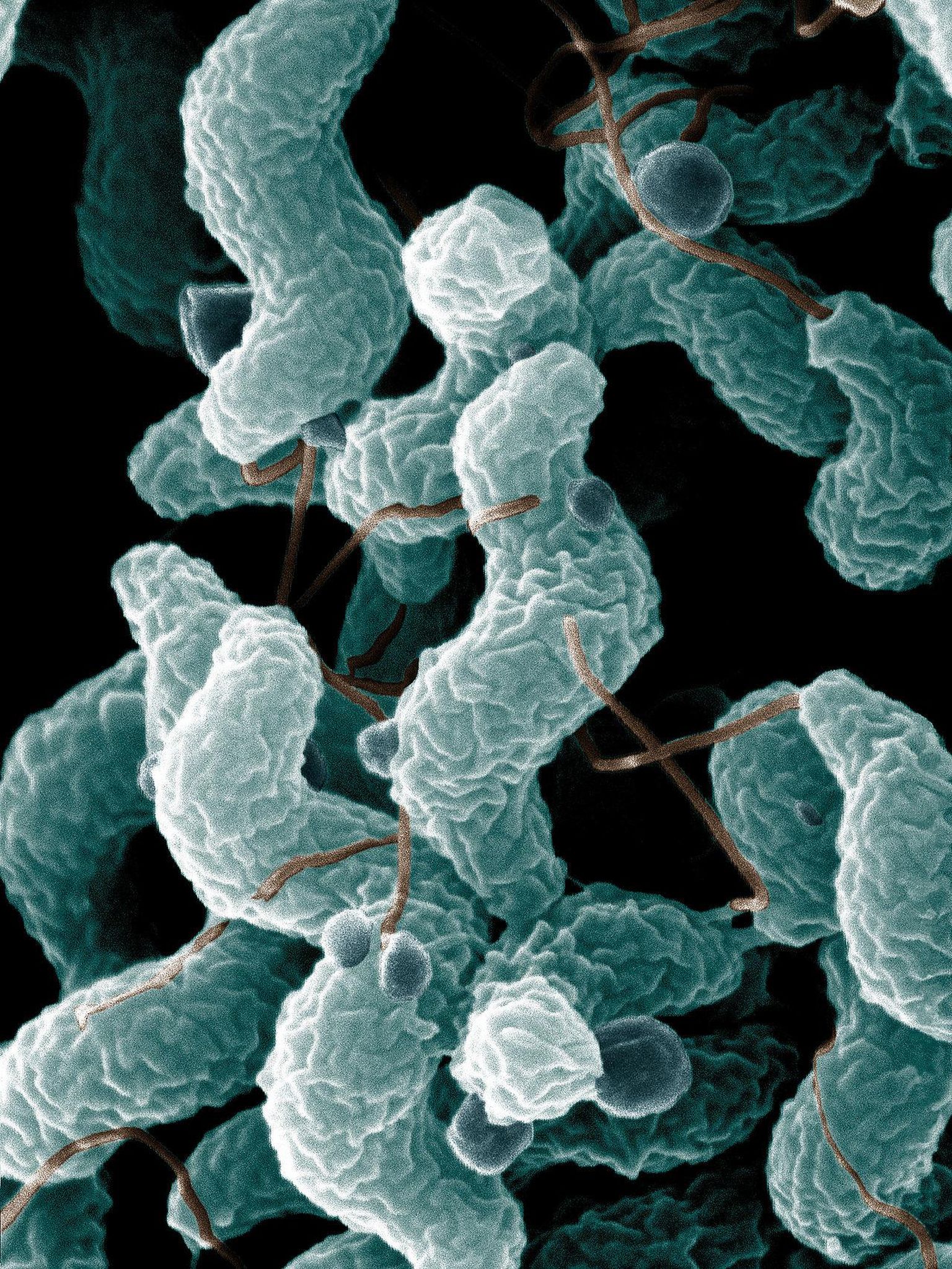 Oksendamise ja kõhulahtisusega kulgeva kampülobakterenteriidi tekitaja on Campylobacter jejuni. See ka loomadel esinev haigustekitaja võib muutuda antibiootikumide toime suhtes allumatuks.