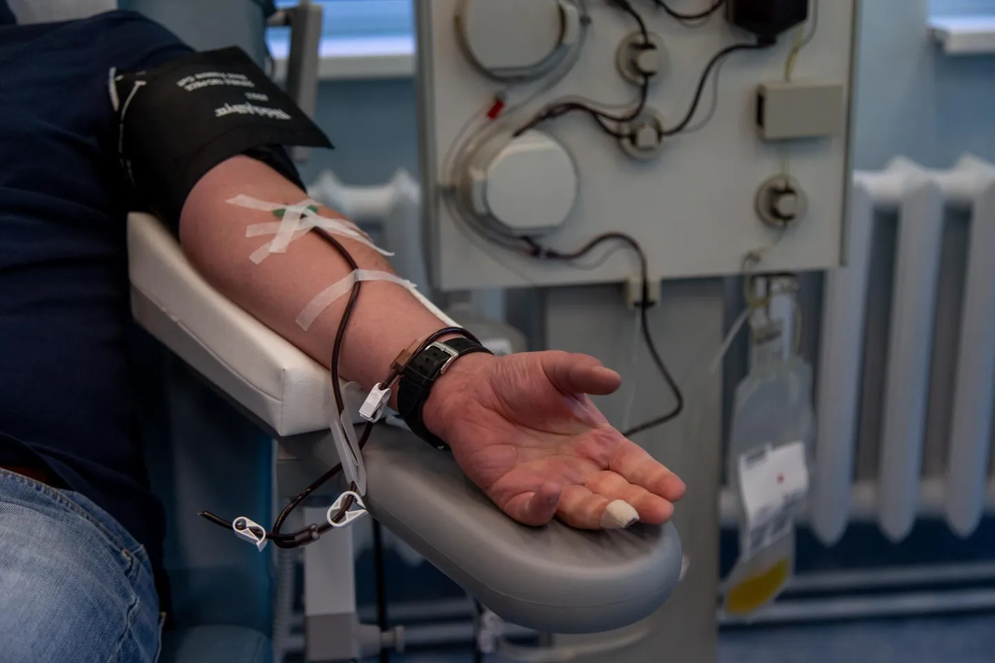 Plasma loovutamine kestab ligi tunni, plasma eraldatakse ja muud vereosised kantakse doonorile kohe tagasi.
