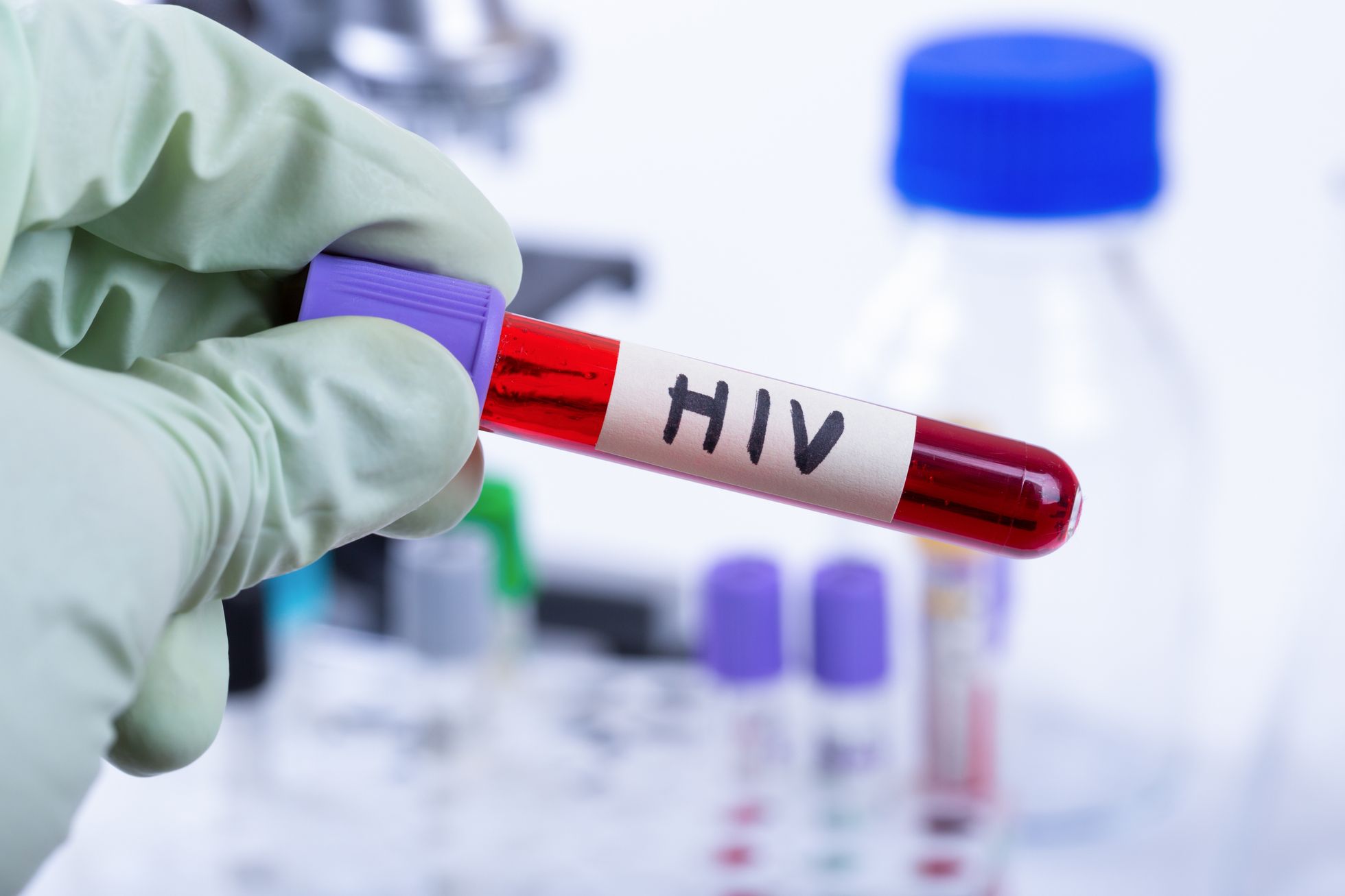 Selle aasta jaanuaris on diagnoositud HIV juba 17 inimesel.