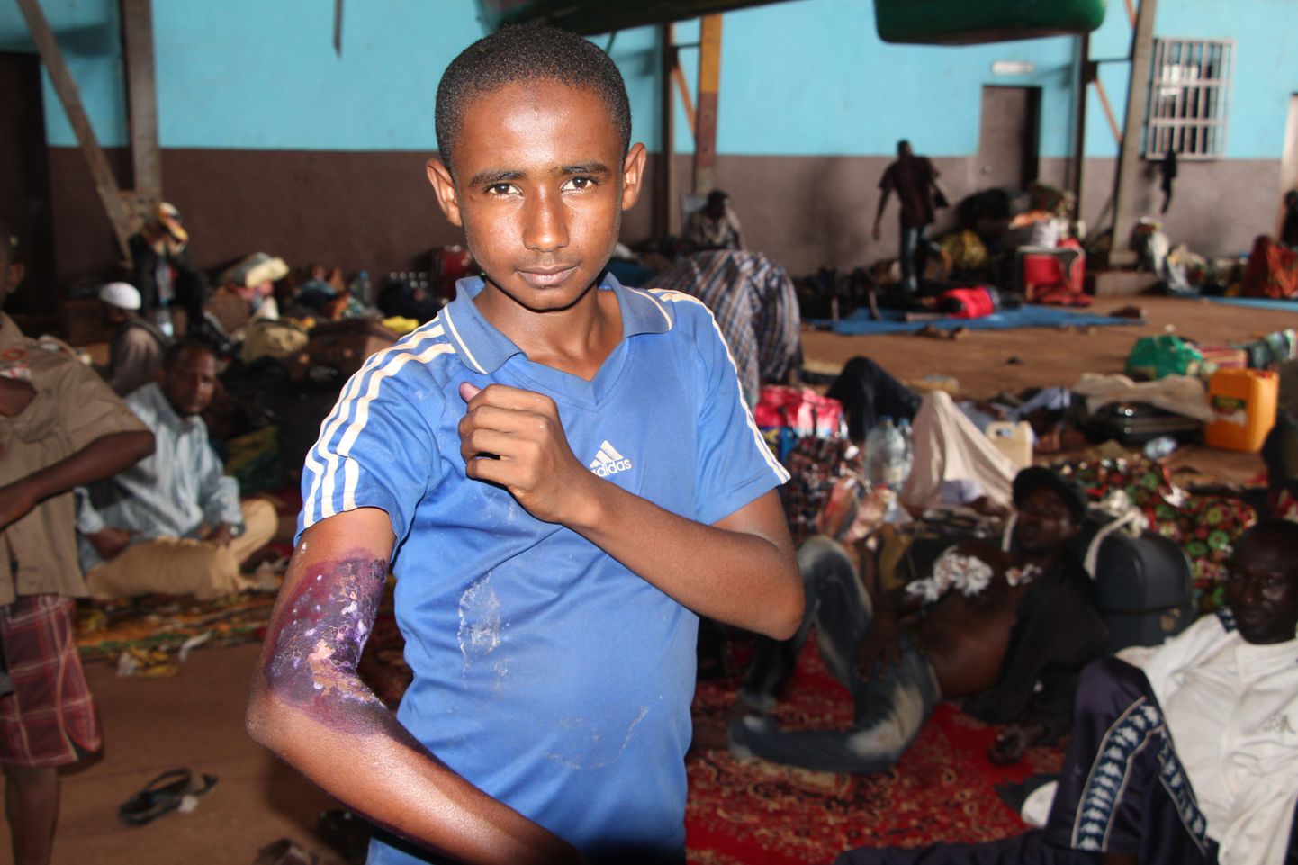 Moslemist laps demonsteeris Bangui lennuväljal sisse seatud varjupaigas oma haava.