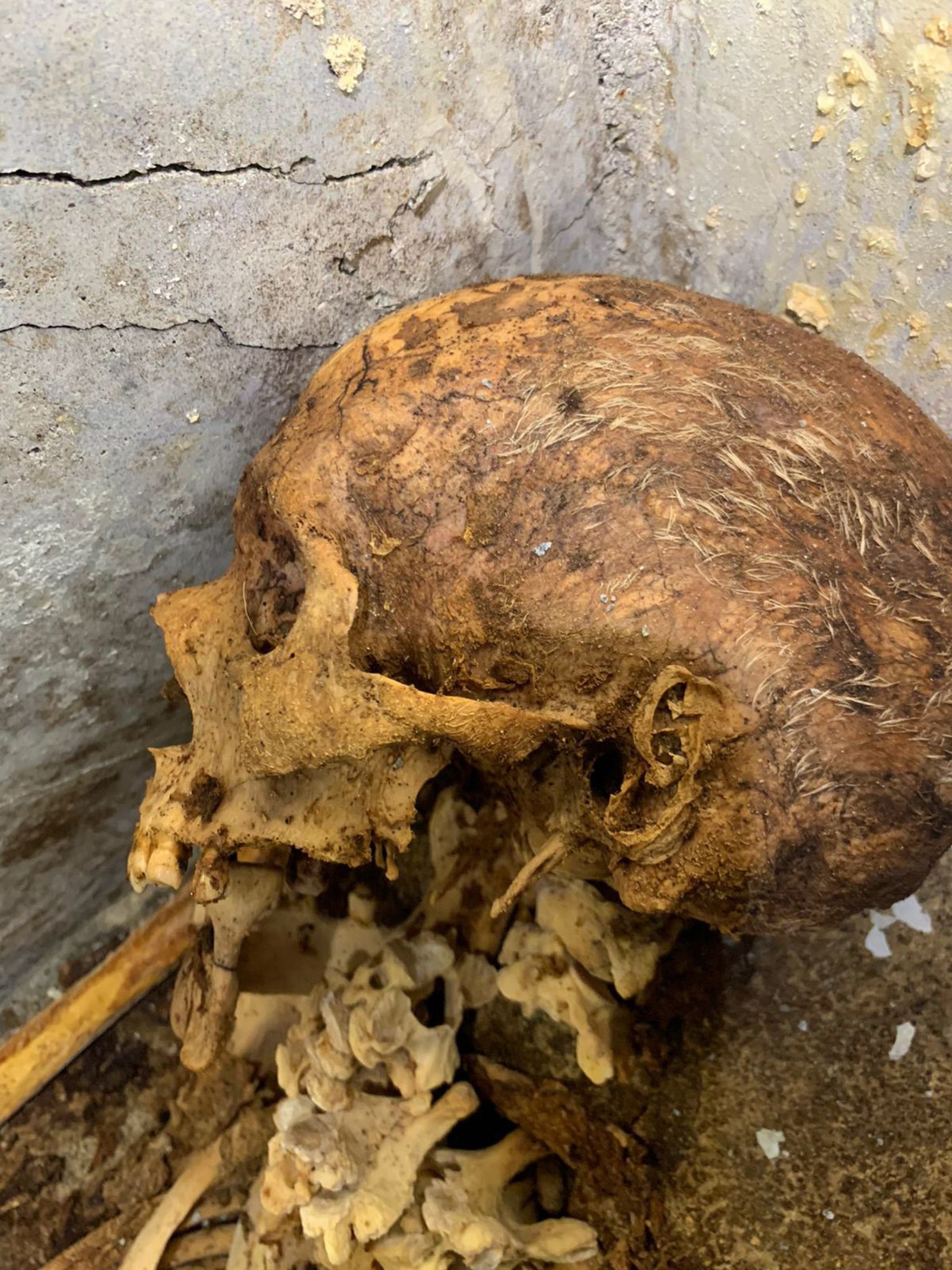Itaalia Pompei arheloogiapargist leitud pooleldi mumifisteerunud mehe skelett. Pildil on näha koljut, millel on osa juukseid alles