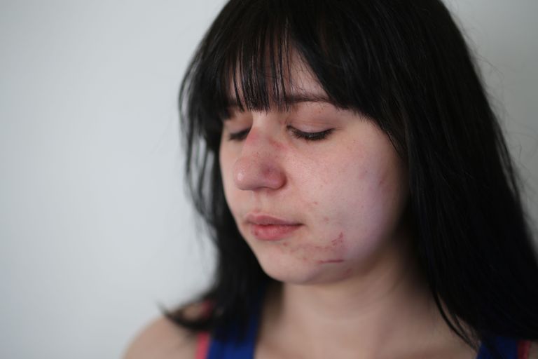 Prooviabielu-Liisa peksti nädalavahetusel jõhkralt läbi