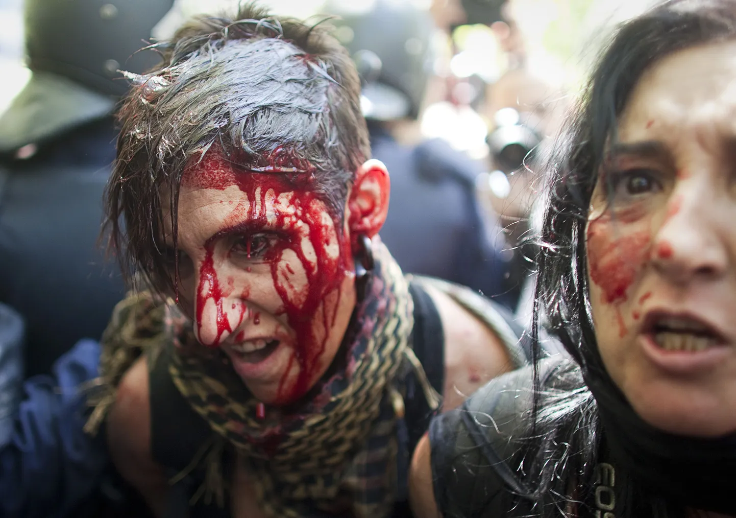 Пострадавшие во время акции протеста в Мадриде
