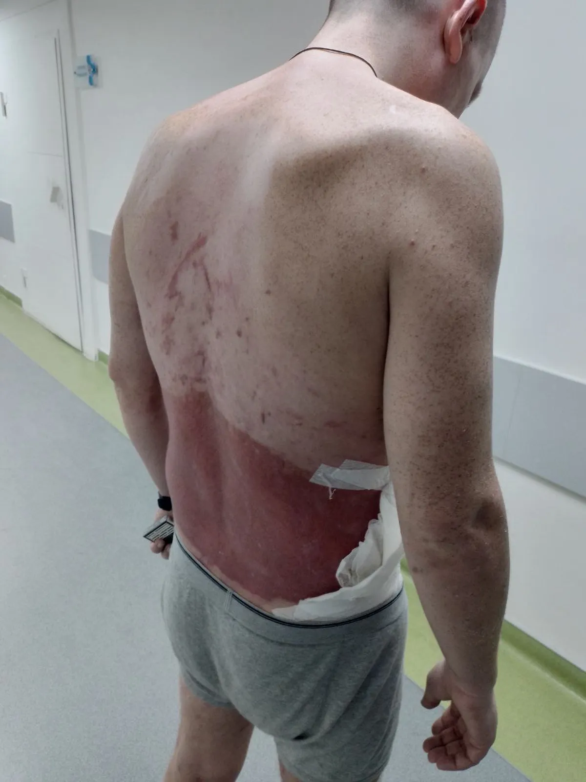 35-летний Юрий Клименко из Мариуполя