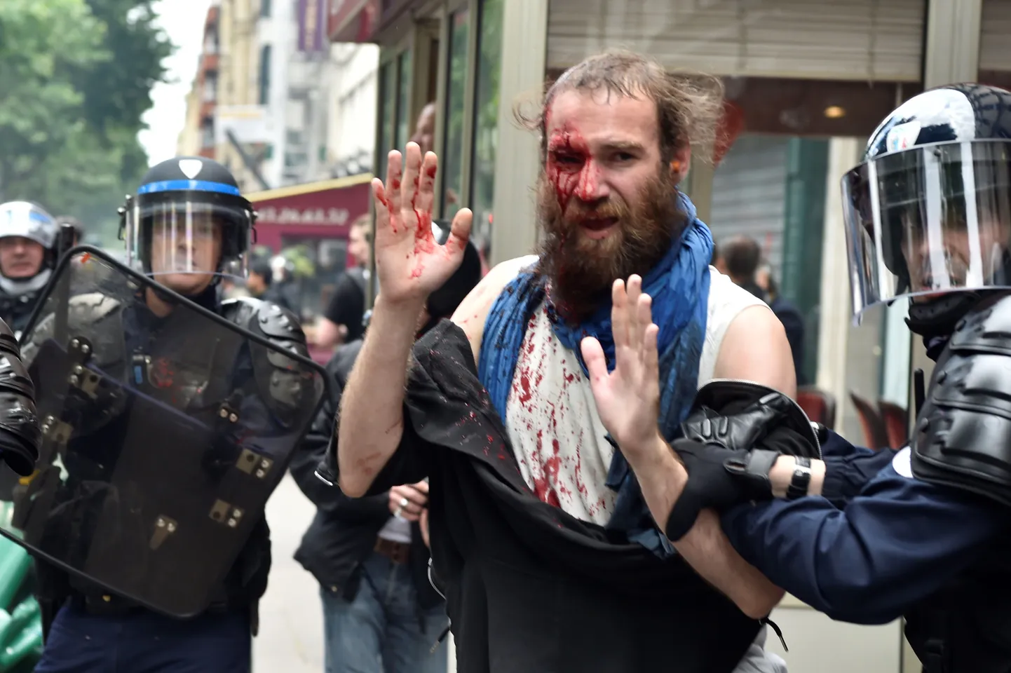 Politsei pidas kinni tööseaduse vastu protesteeriva vigastatud meeleavaldaja