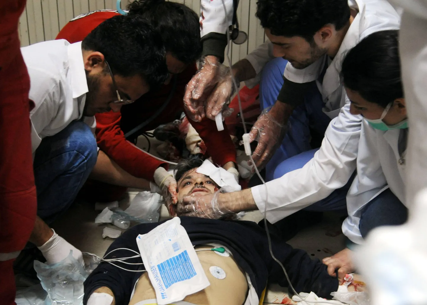 Douma keemiarünnakus viga saanud mees.