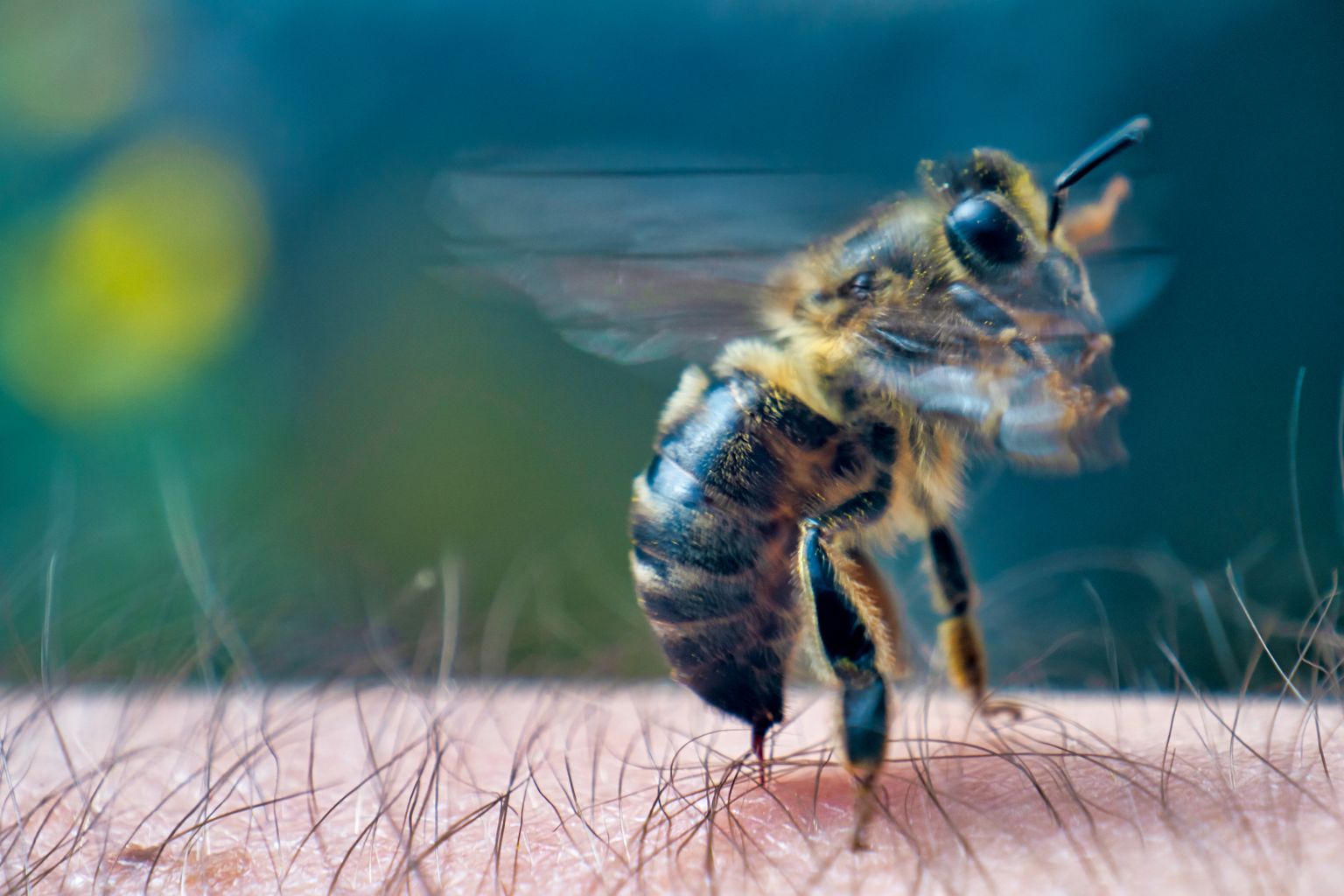 Mesilane jätab torkekohta nõela, herilane mitte – kui ta aga järsult eemale lüüa, võib ka herilase nõel torkekohta jääda. Oluline on nõel ettevaatlikult eemaldada.
