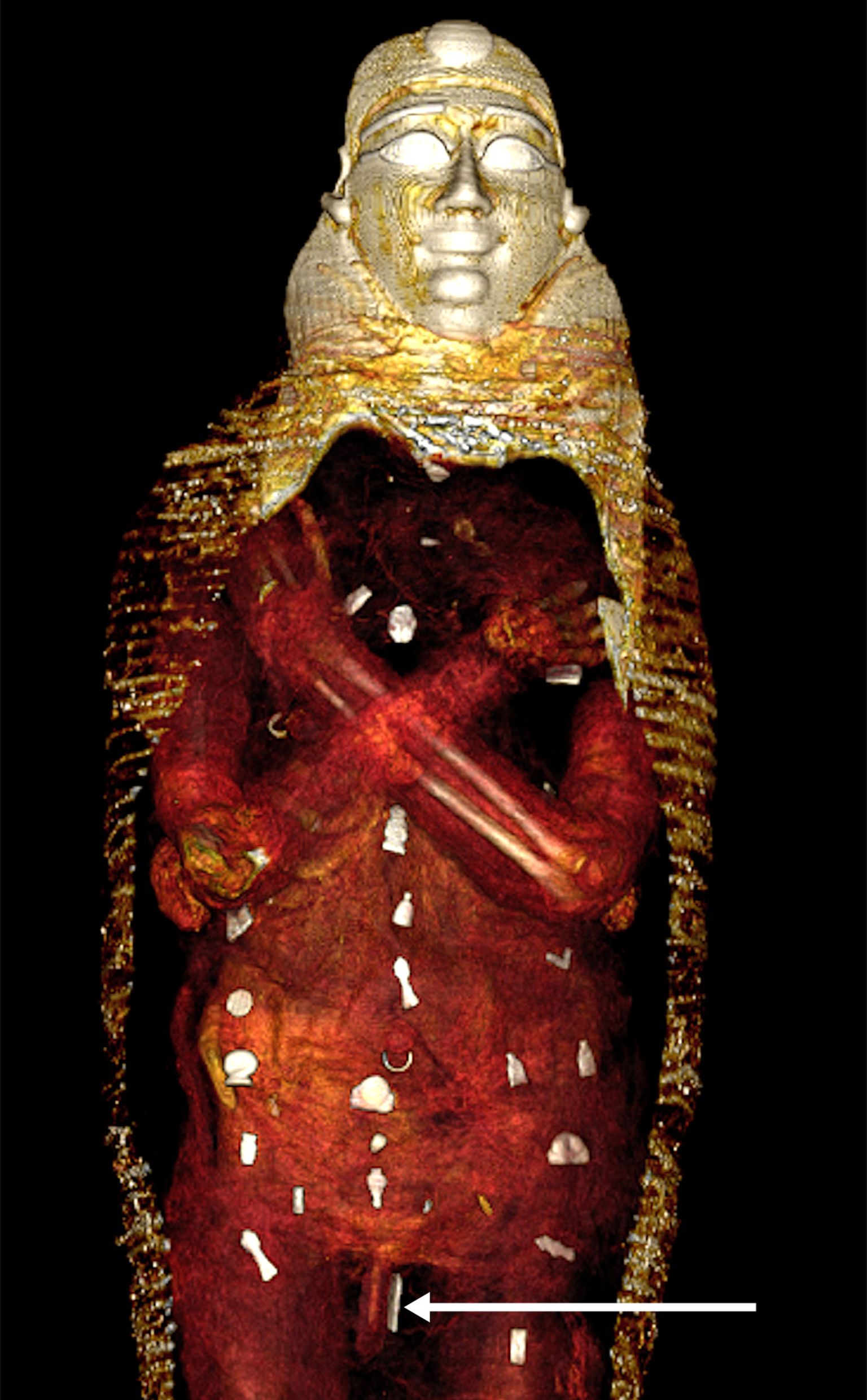 Vana-Egiptuse muumia kompuutertomograafiline uuring näitas, et ta suri 14-15-aastasena ja ta maeti koos 49 amuletiga, mis pidid teda iidsete egiptlaste arusaamade kohaselt teispoolsuses kaitsma