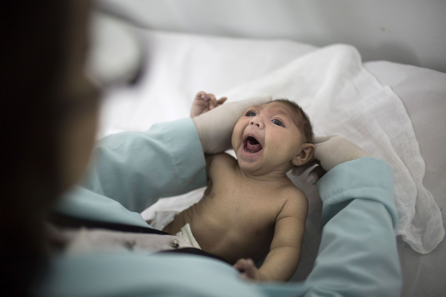 Brasiilias on Zika viirus ajuga seotud sünnidefekte tekitanud rohkem kui 1200 lapsel.