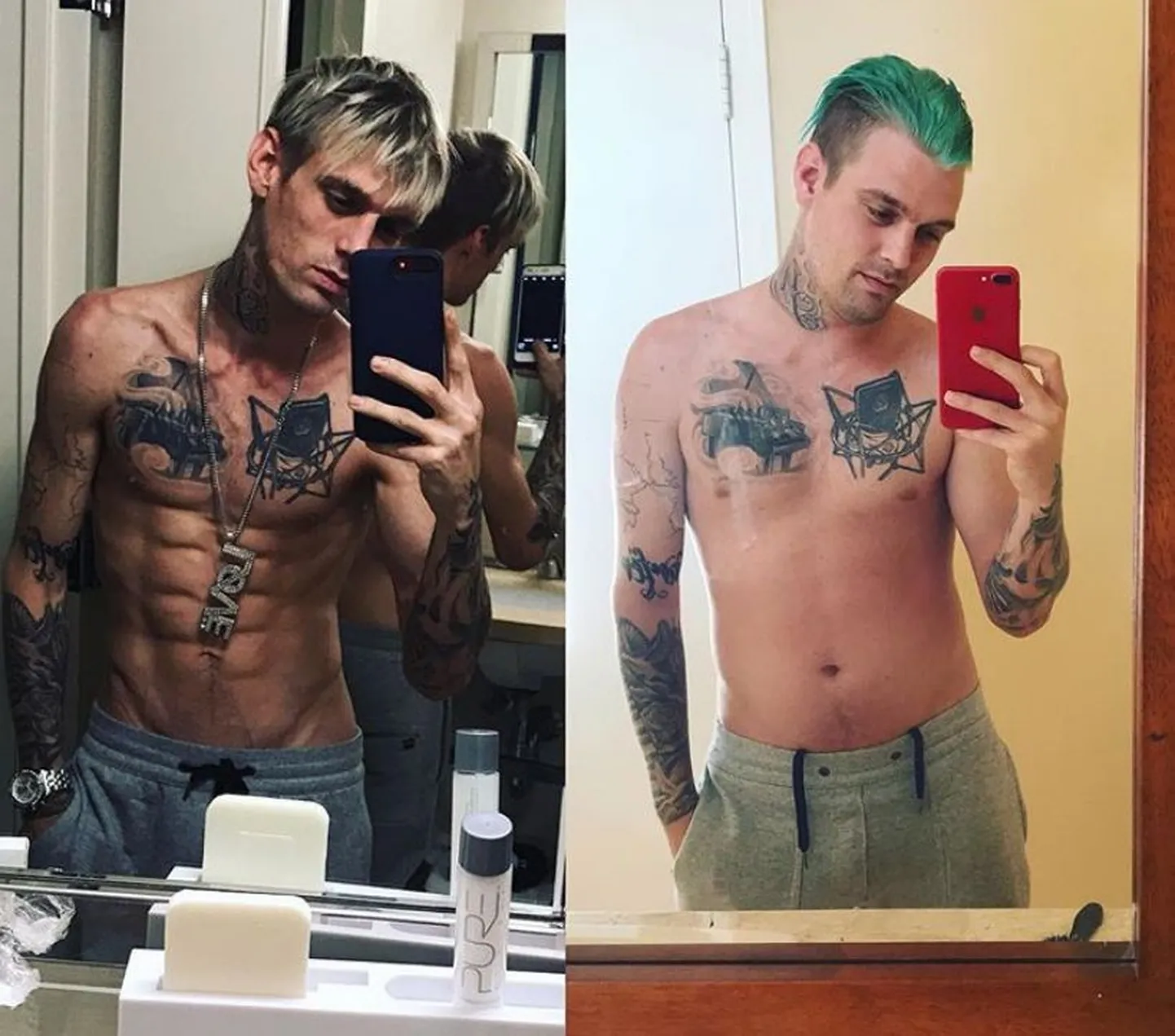 Aaron Carter näitab kaalutõusu