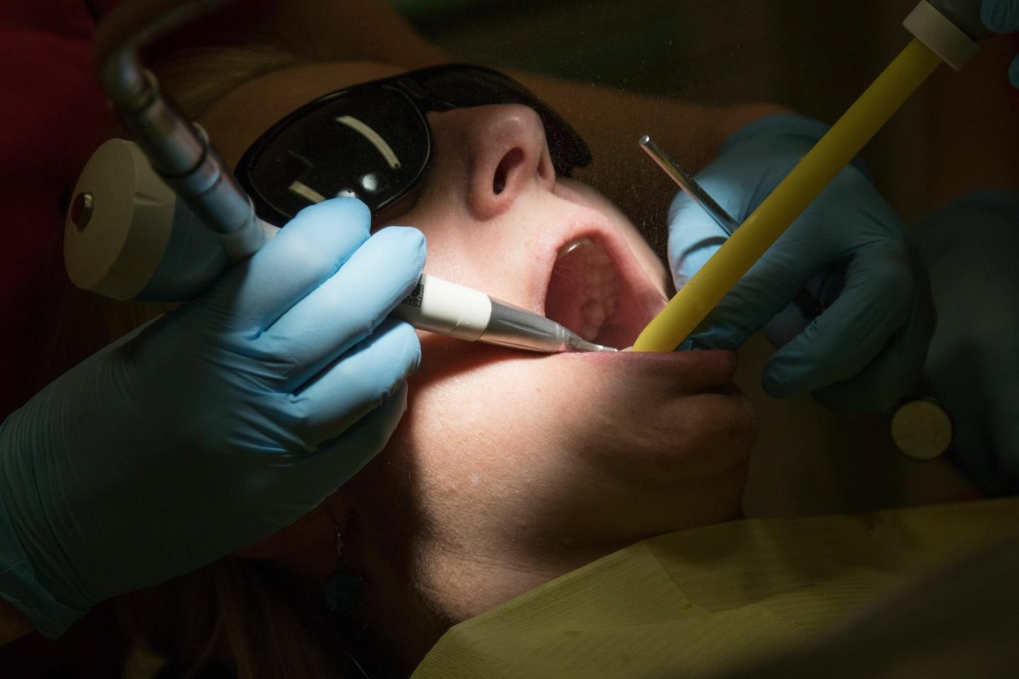 Hambakirurgia puhul tuleb tähelepanu pöörata järelravile.