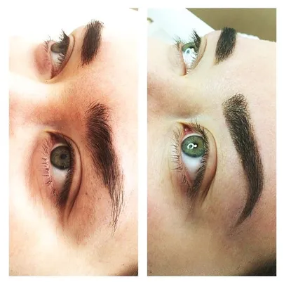 Enne ja pärast (foto: BeautyBar)