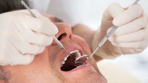 Департамент здоровья: просите у зубных врачей пломбы без ртути