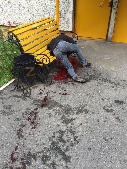 Пострадавший в ходе резни в Сургуте./ Фото: официальное сообщество Сургута