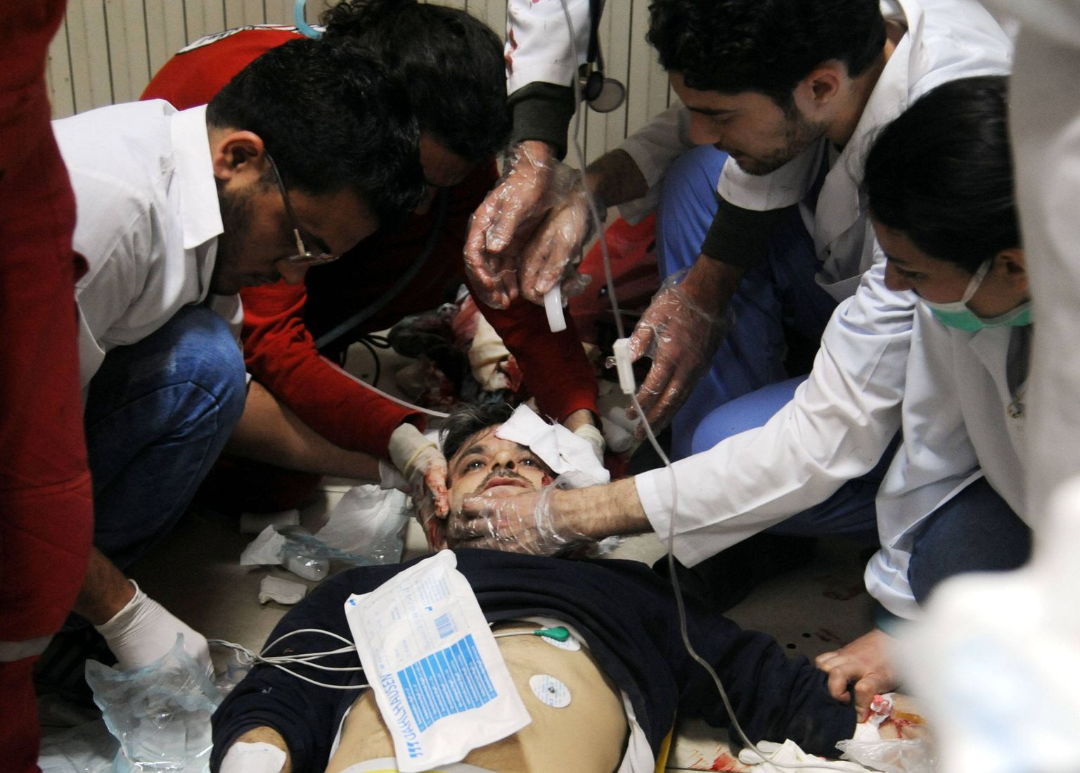 Жертва химической атаки в Думе.