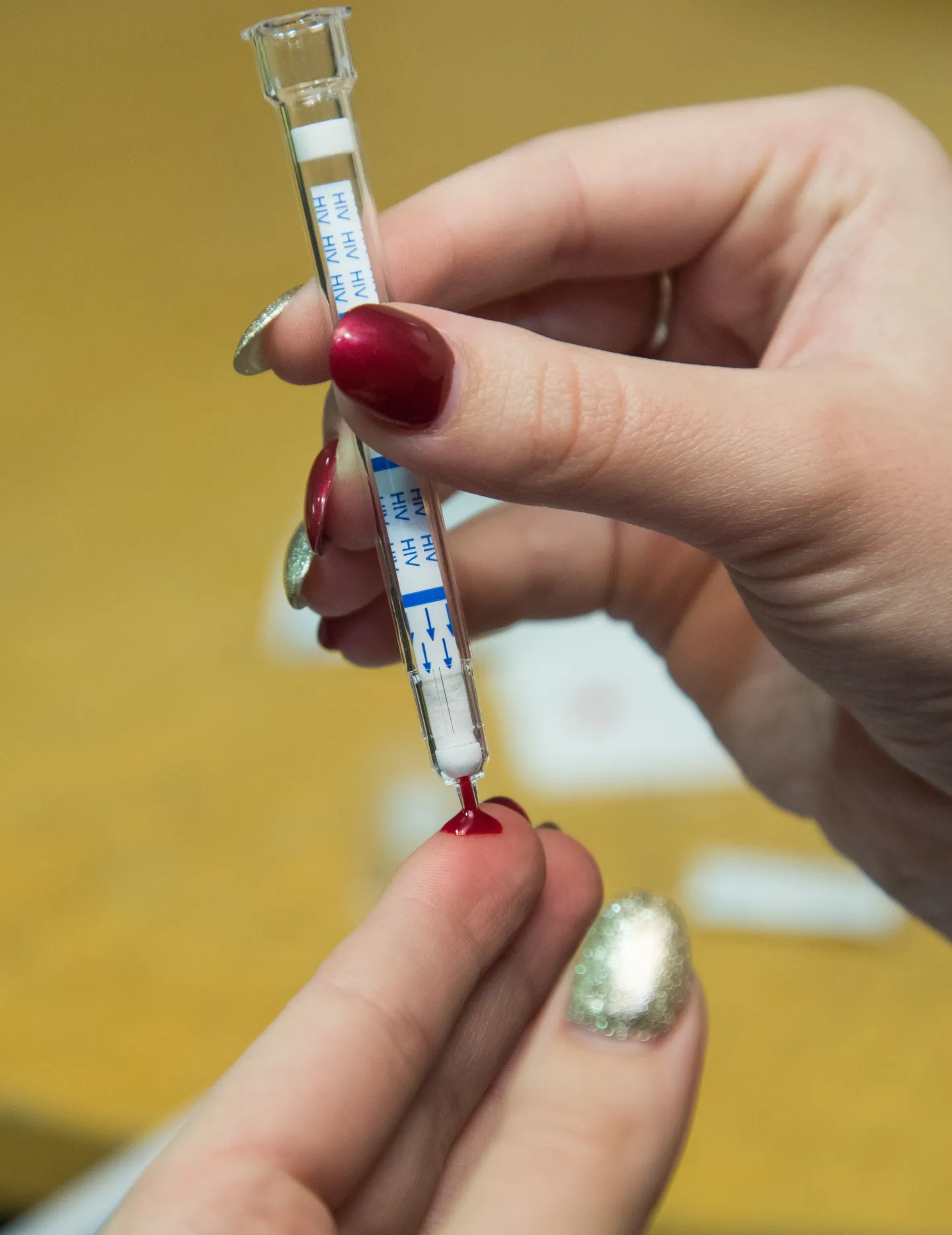 HIV kiirtest aitab ohtlikku nakkust avastada.