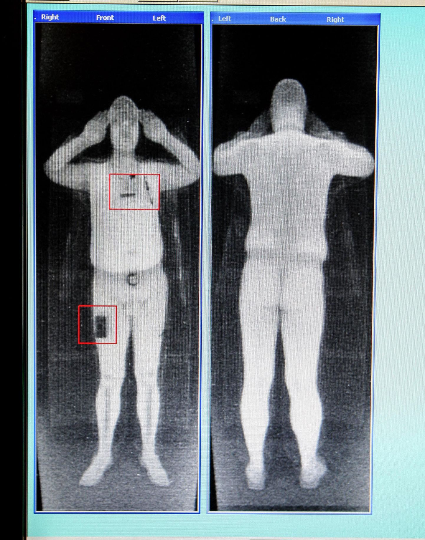 Selline pilt avaneb inimesest röntgenkaamera ees.