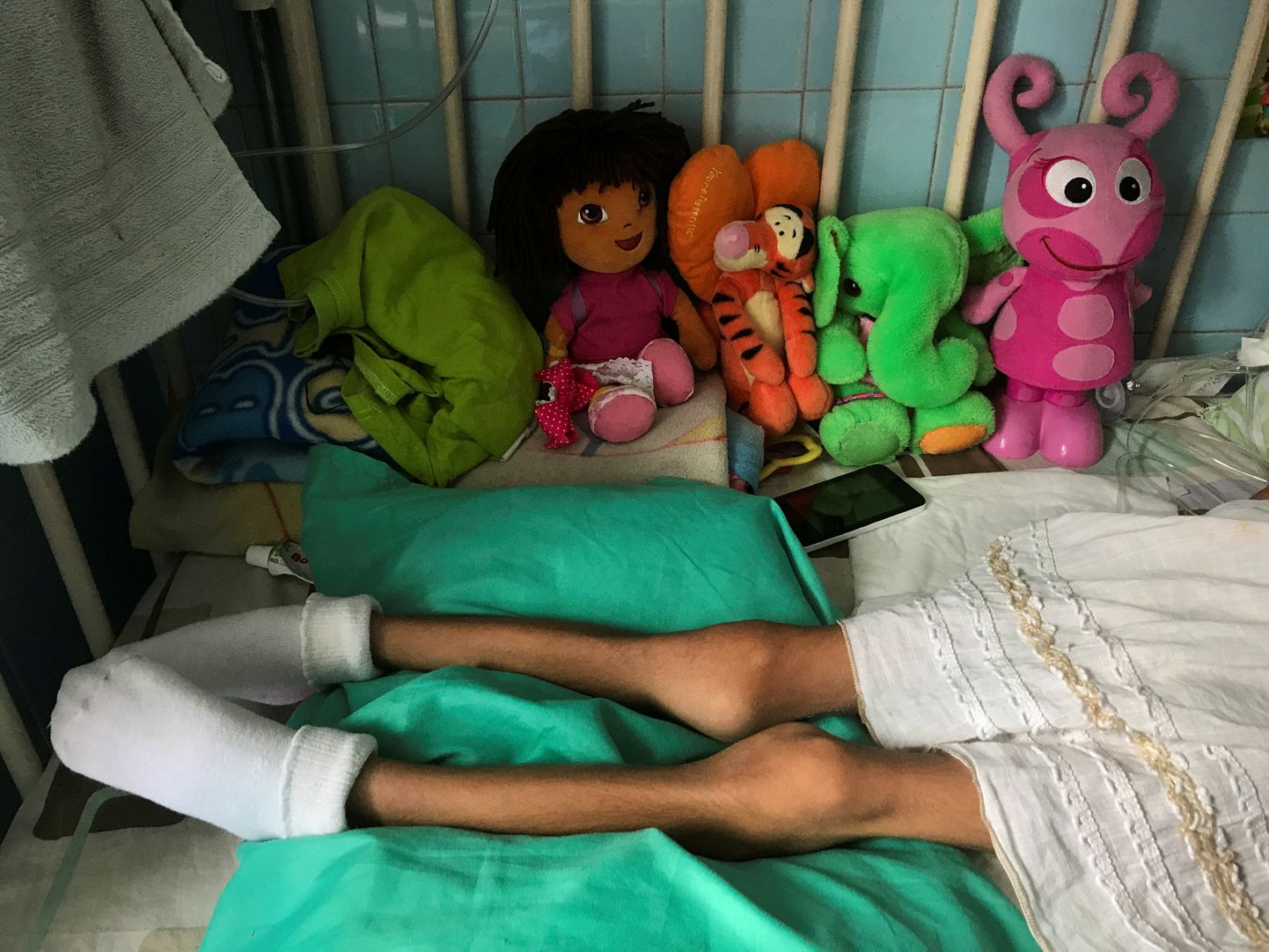 Alatoitunud laps Venezuela haiglas.