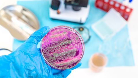 This common habit after traveling allows bacteria and pathogens to thrive