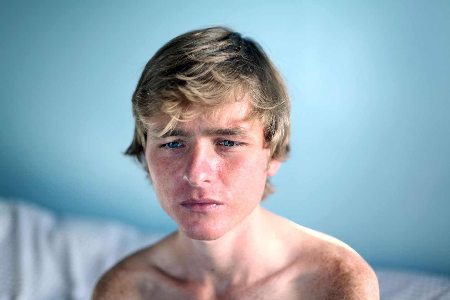 Лучшее портретное фото года сняла Лаура Паннак из журнала Guardian. На снимке - больной анорексией мальчик Грэхем.