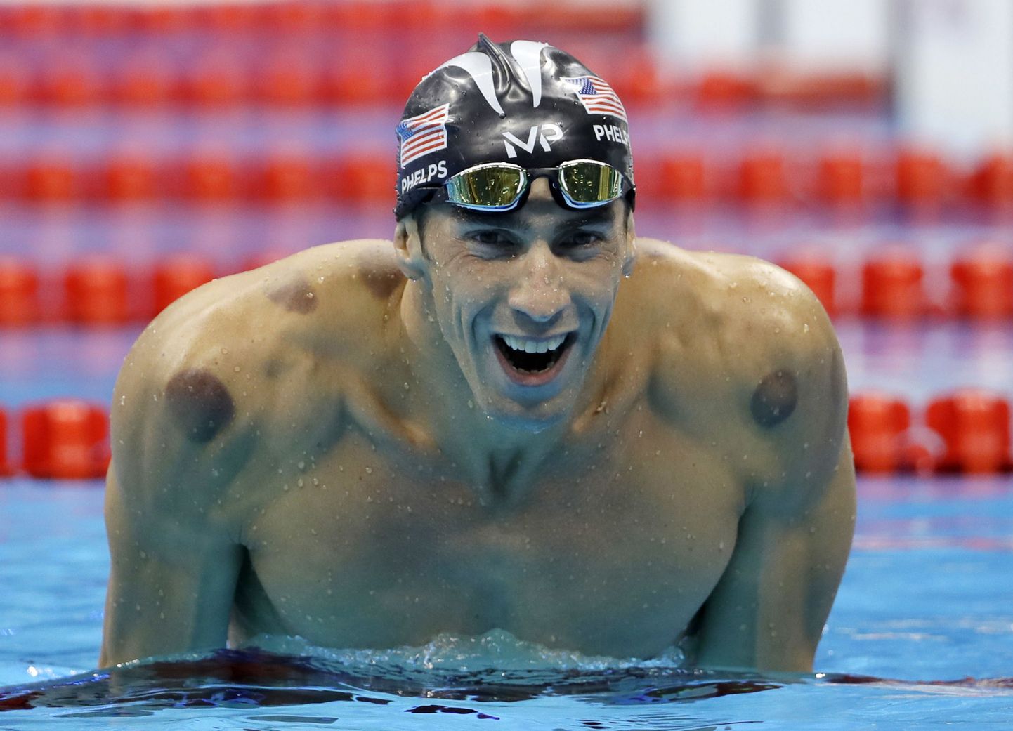 Michael Phelpsi õlgadel asetsevad jäljed kupuravist.