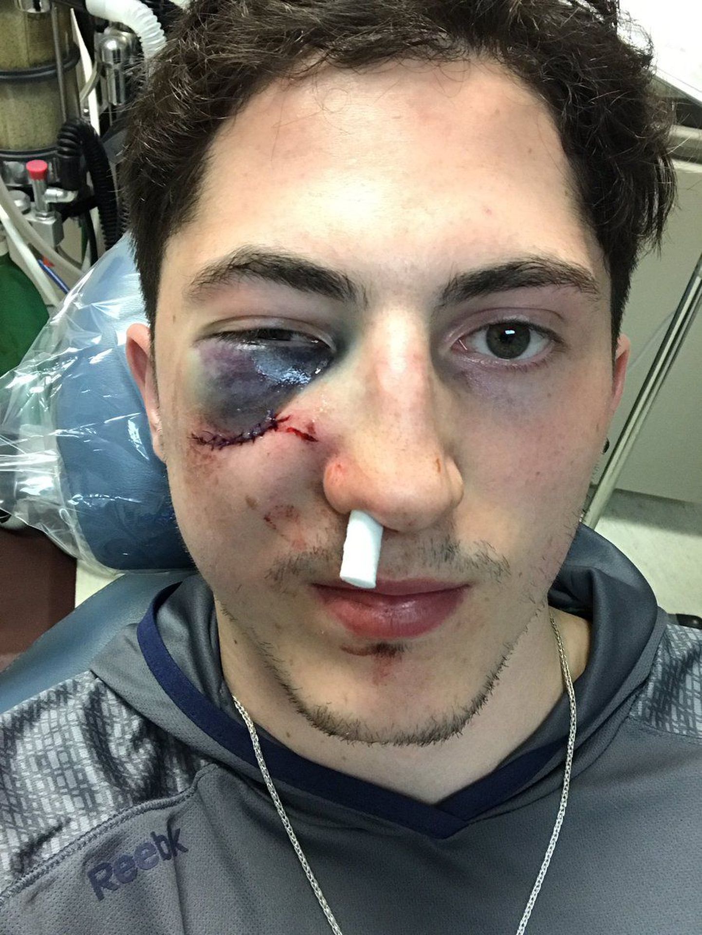 Zach Werenski sai litriga tabamuse vastu nägu.