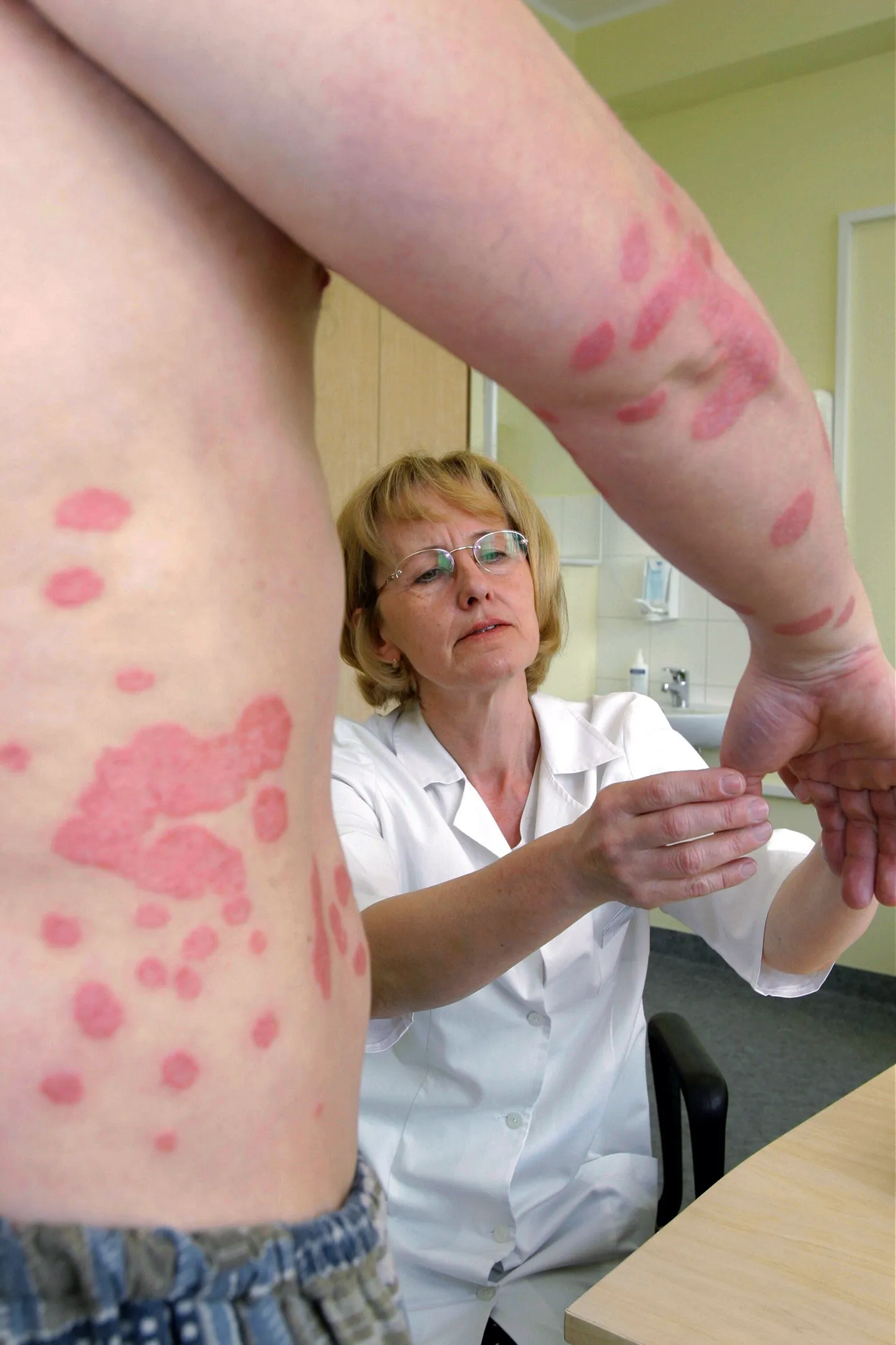 Pildil SA Tartu Ülikooli kliinikumi nahakliiniku dotsent Sirje Kaur uurimas psoriaasiga patsienti.
