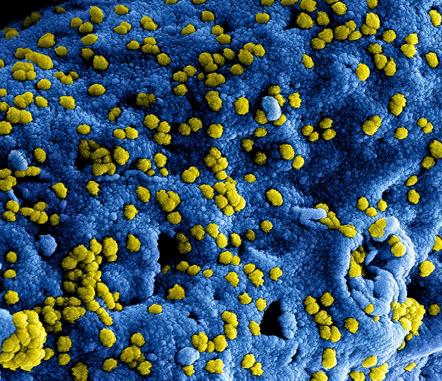 SARS-Cov-2 viiruseosakesed