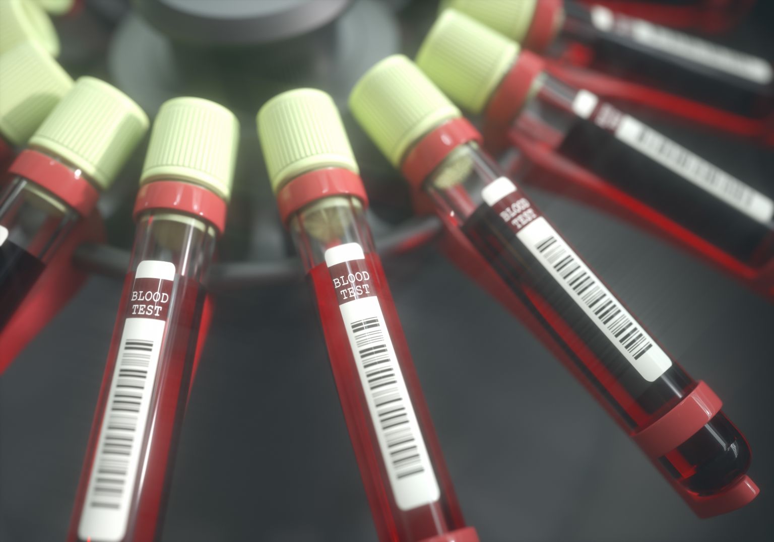 NIPT testiga tehakse loote kromosoomhaigused kindlaks ema verest.