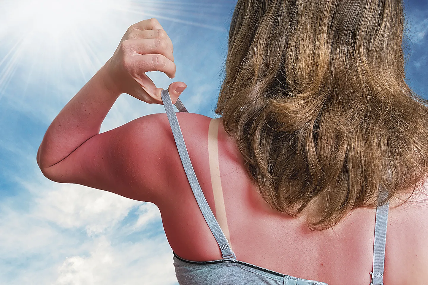 Ehkki ohutut päevitamist pole olemas, soovitab naha­arst, et kui inimene siiski otsustab randa päikest püüdma minna, tuleks 20 minutit enne päikese kätte minekut määrida nahale päikesekaitsekreemi.