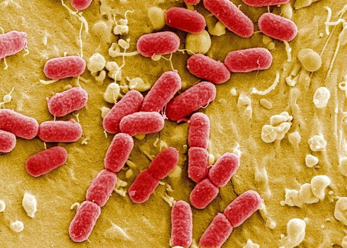Бактерия. Иллюстративный снимок