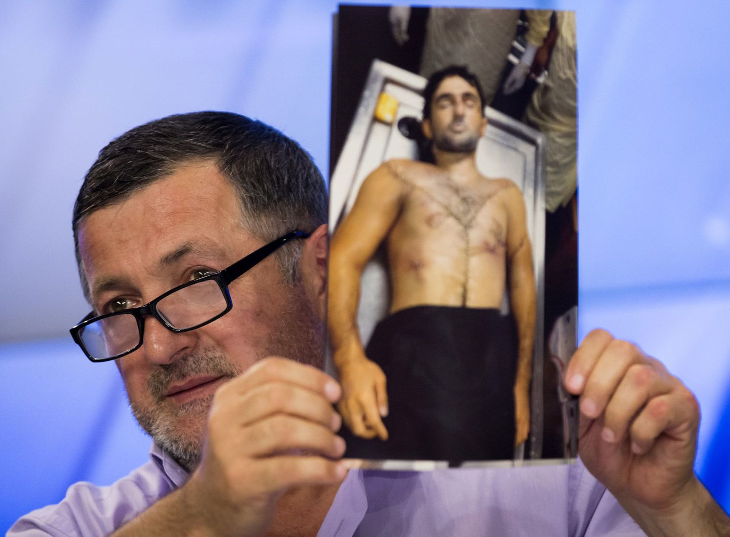 Abdulbaki Todašev näitas täna Moskvas toimunud pressikonverentsil väidetavalt oma tapetud poega kujutavat fotot.