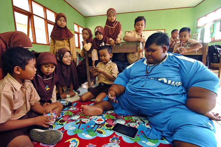 Арья Пермана, 12-летний мальчик из Индонезии, который весил более 190 кг, сбросил больше половины веса.