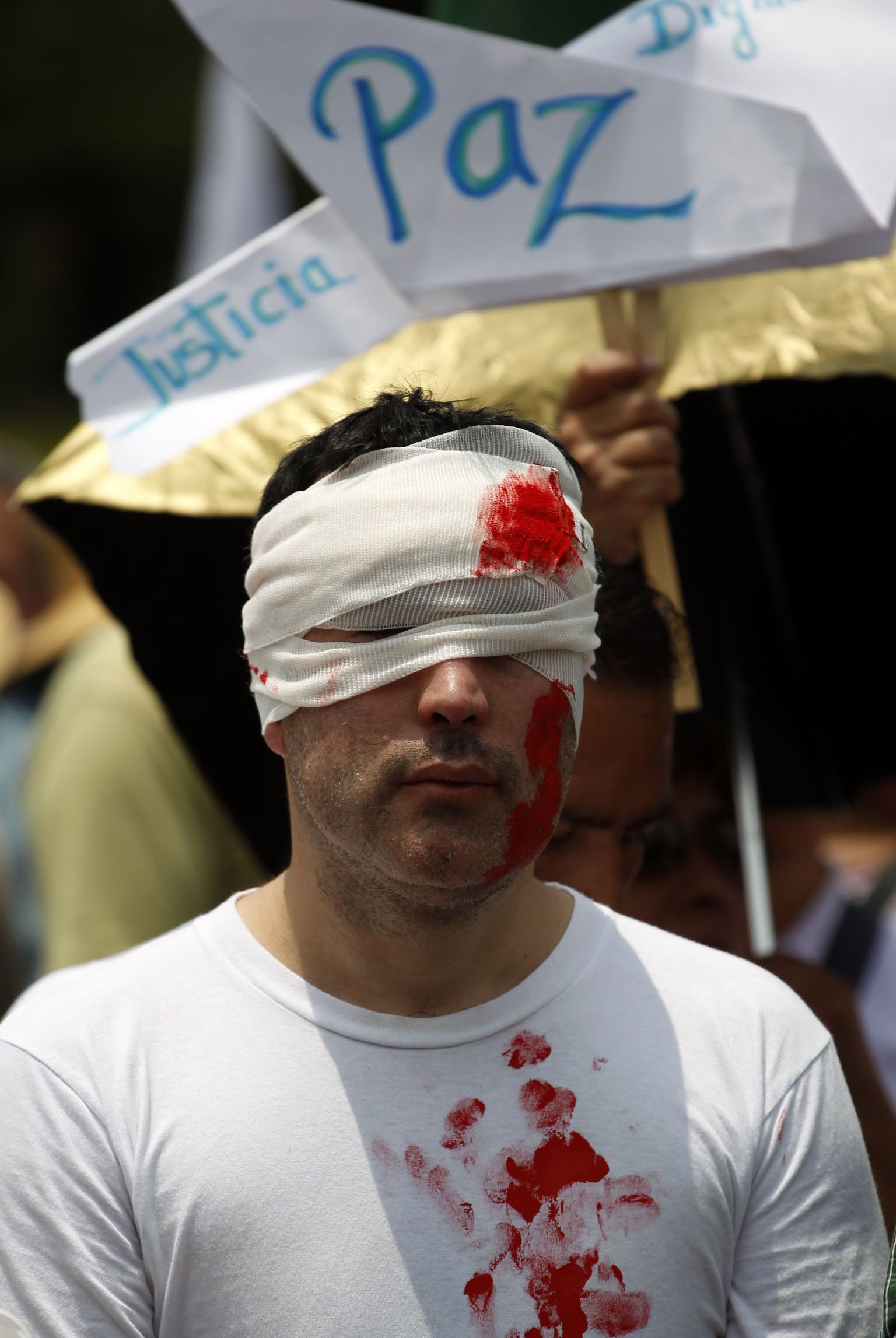 Võltsvere ja sidemetega kaetud vägivallavastane meeleavaldaja eelmisel kuul Mexico City's. 

A demonstrator, who covered his head with bandage and faked blood, attends a march to protest against violence that paused for a few minutes just outside the presidential residence of Los Pinos in Mexico City, Sunday Aug. 14, 2011. The continuing tide of drug-related killings in Mexico has drawn thousands of protesters to march against violence.(AP Photo/Eduardo Verdugo) / SCANPIX Code: 436