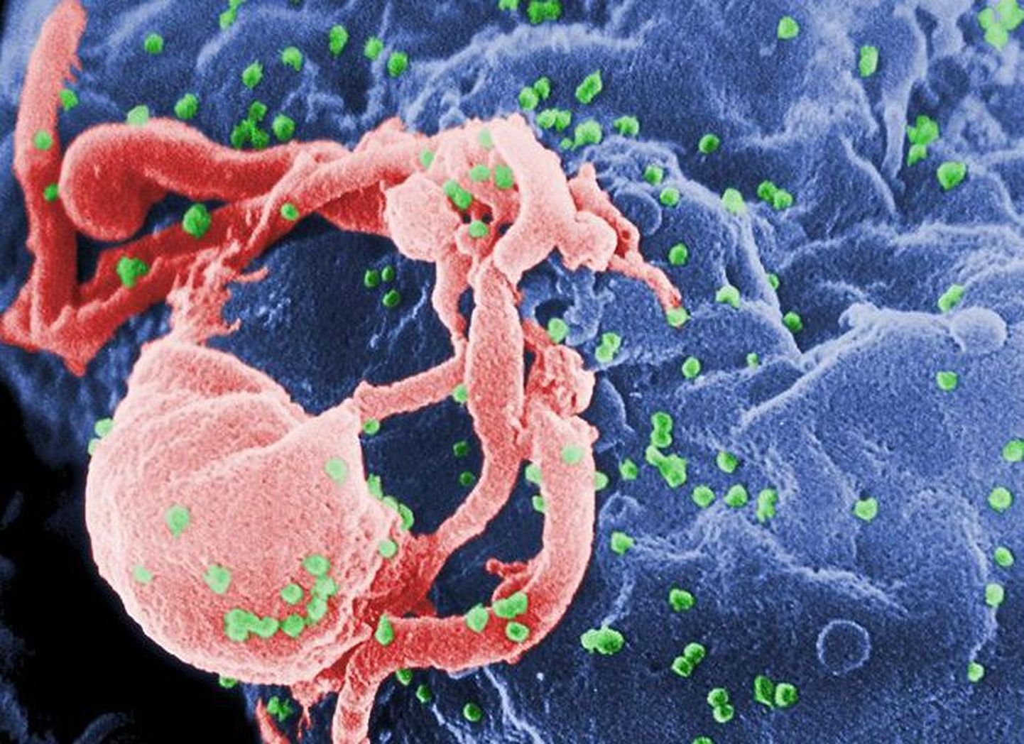 HI-viirus mikroskoobi all suurendatuna