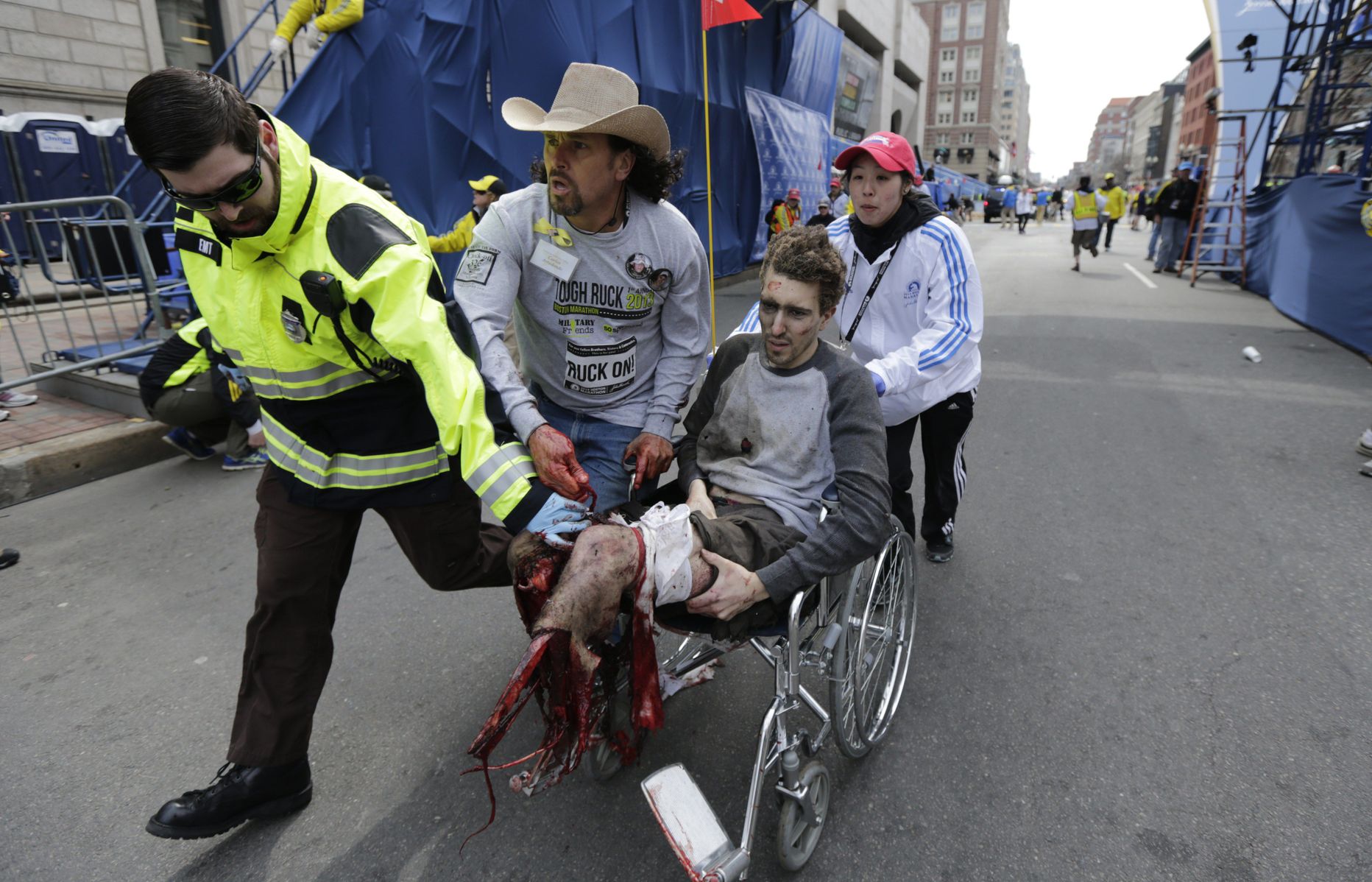Jeff Bauman kaotas Bostoni pommirünnakus mõlemad jalad