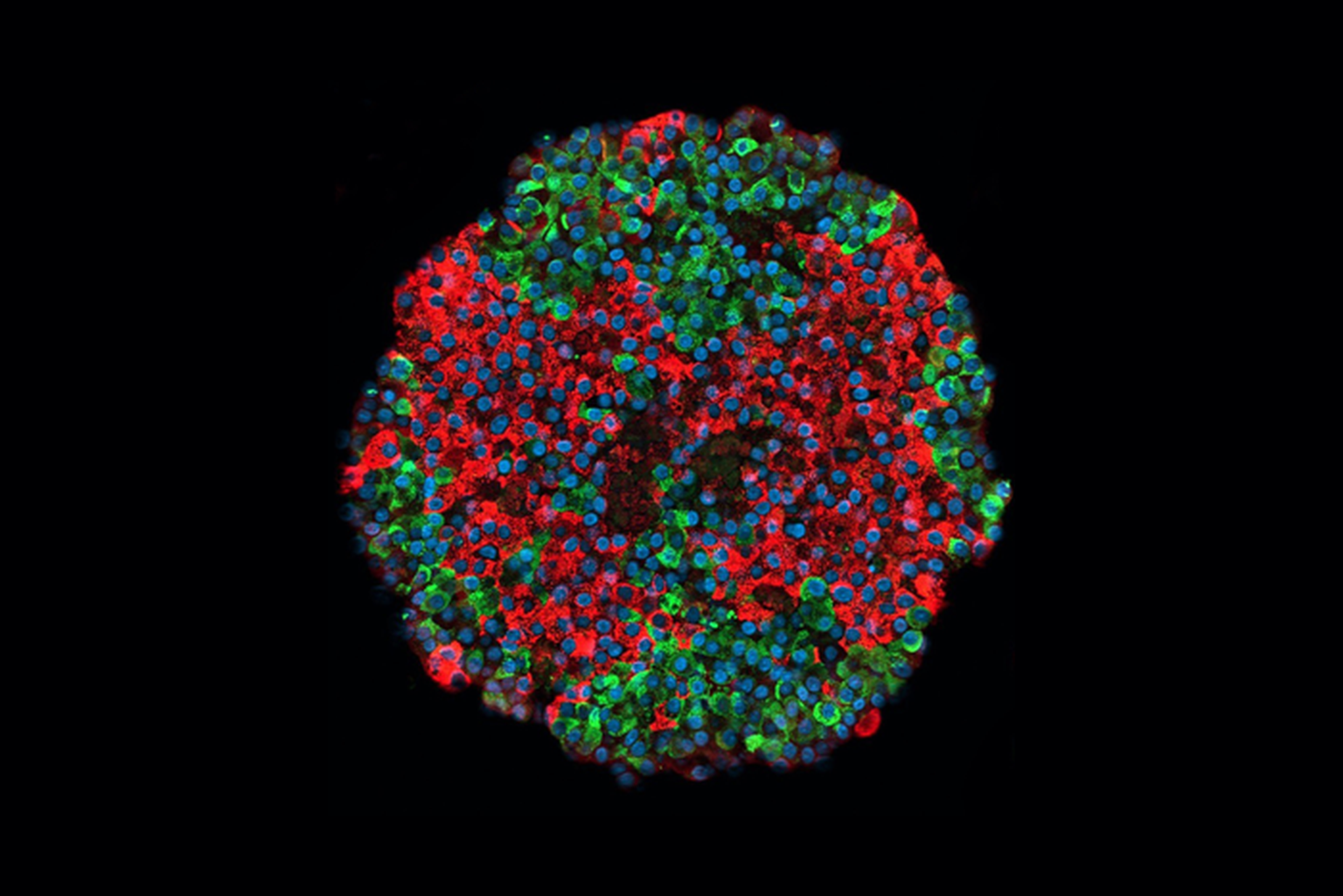 Pildil on tüvirakkudest toodetud pankrease saareke. Insuliini tootvad rakud on märgitud punasega ja glükagooni tootvad rakud rohelisega.