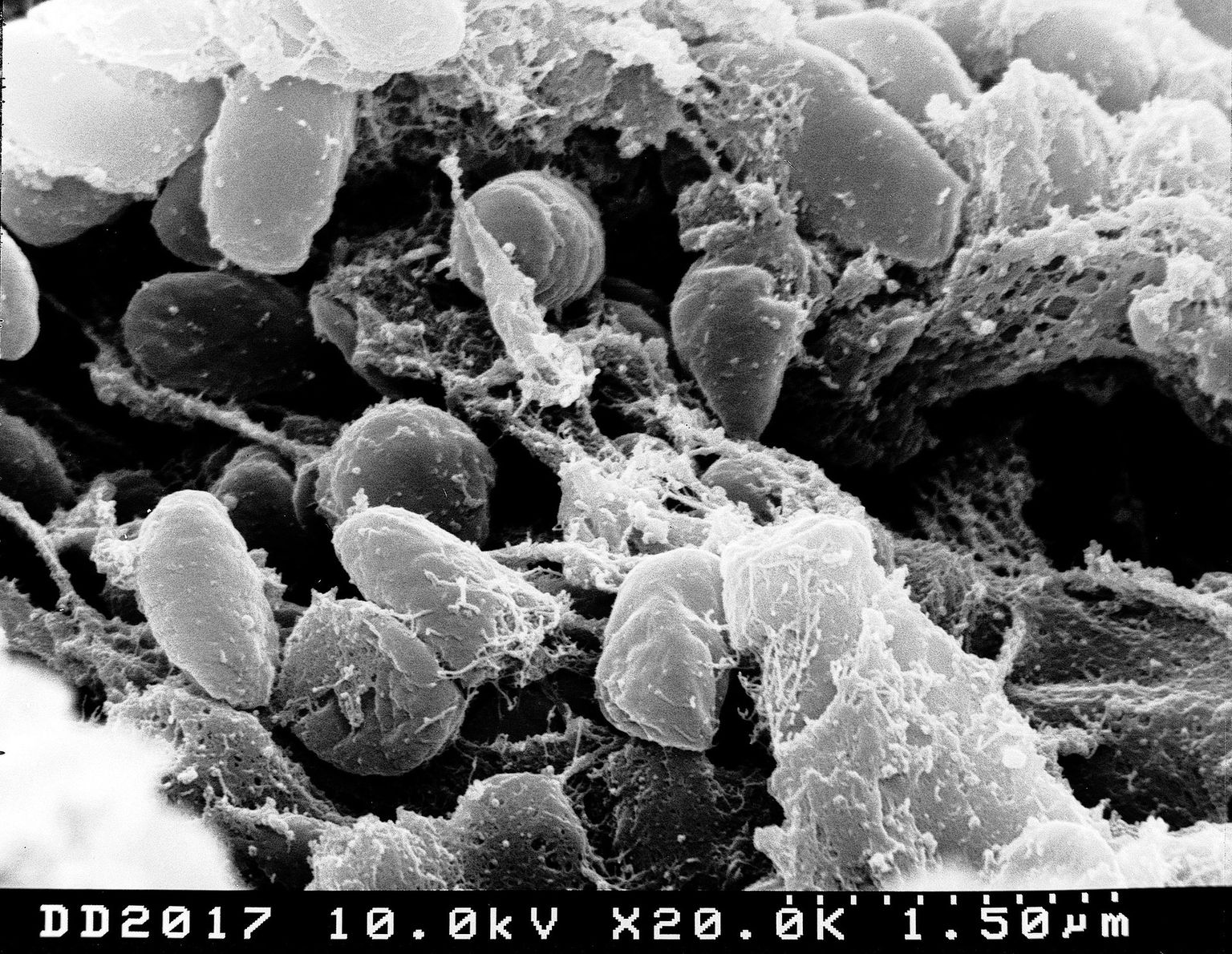 Vīruss mikroskopa attēlā. Ilustratīvs attēls.