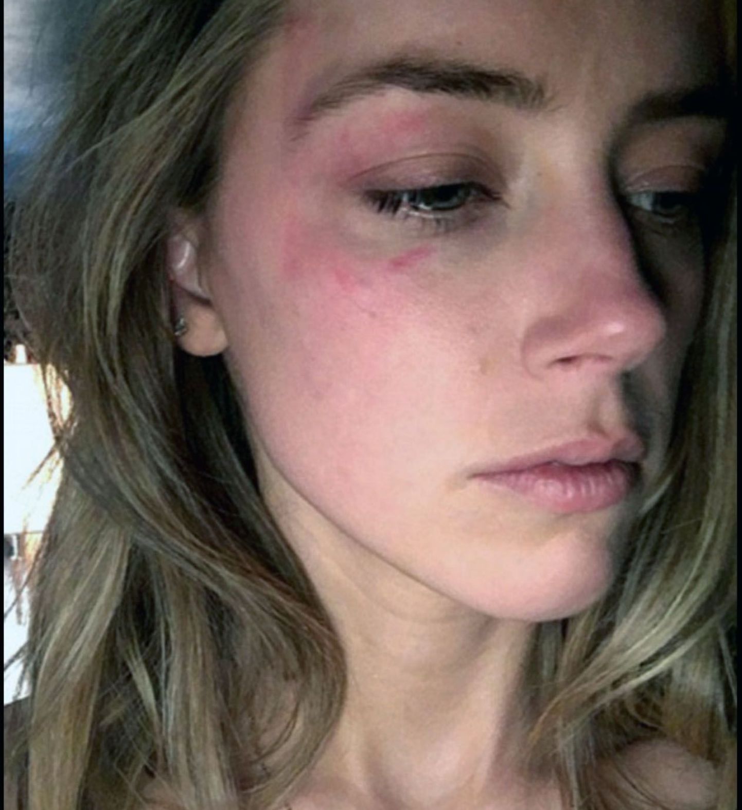 Amber Heard väidab, et abikaasa Johnny Depp ründas teda