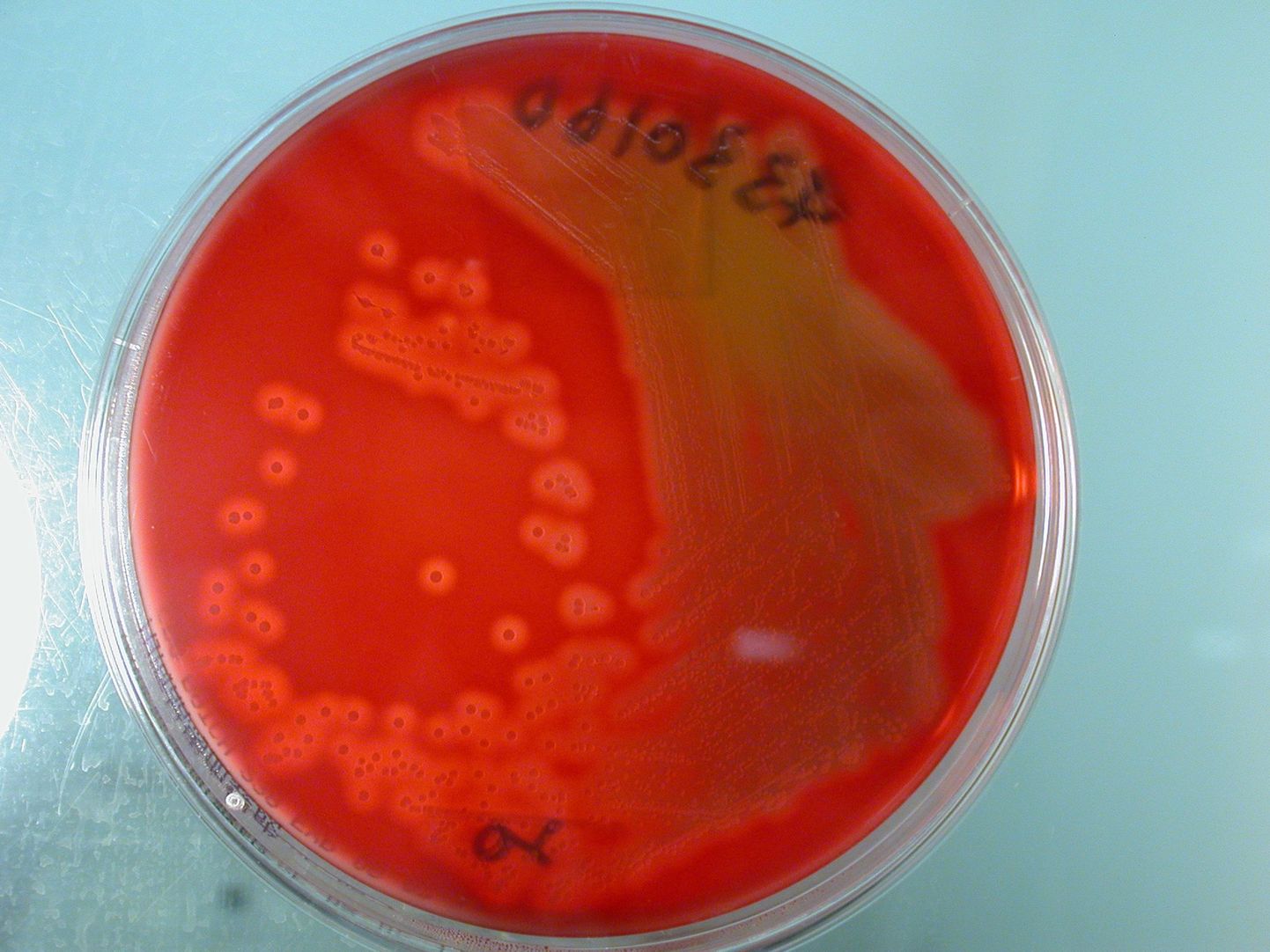 Hong Kongis sarlakeid põhjustanud Streptococcus pyogenes.